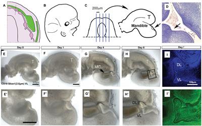 Development of the Vestibular Lamina in Human Embryos: Morphogenesis and Vestibule Formation